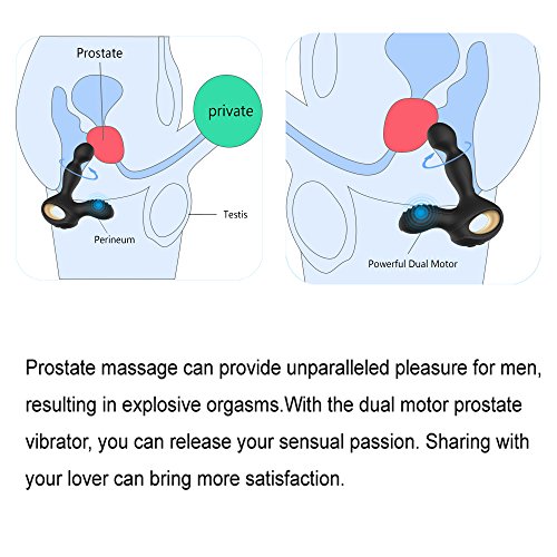 Máy rung hậu môn Cako NV Toys sưởi ấm điều khiển từ xa