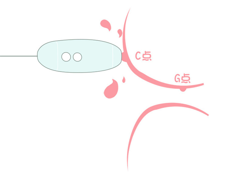 Trứng Nhảy Kis Toy Hút Rung Mạnh Miss VV USA Siêu Phê