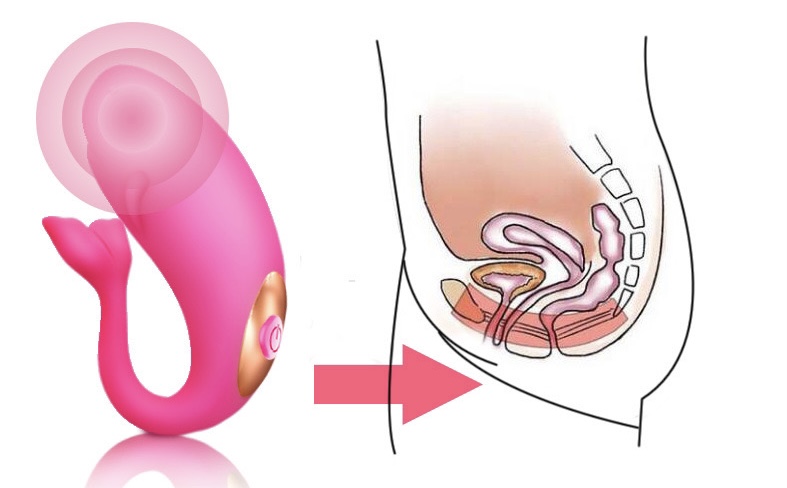 Trứng rung điều khiển từ xa cá heo kích thích điểm G hiệu quả